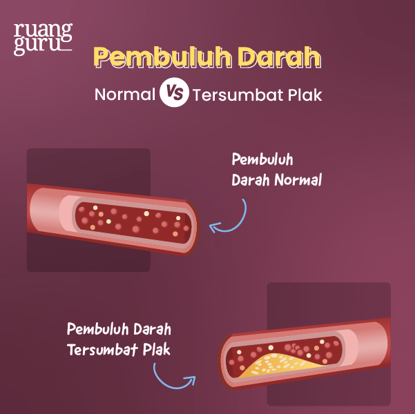 Fakta Seru - Bahaya Rebahan - Menyebabkan Hipertensi